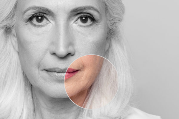 How to prevent the appearance of jowls…